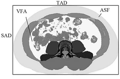 <mark class="highlighted">Bioimpedance analysis</mark> combined with sagittal abdominal diameter for abdominal subcutaneous fat measurement